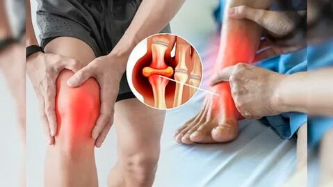 Odos sritys, tinkamos tepti Icexin geliu (keliai, alkūnės, apatinė nugaros dalis)