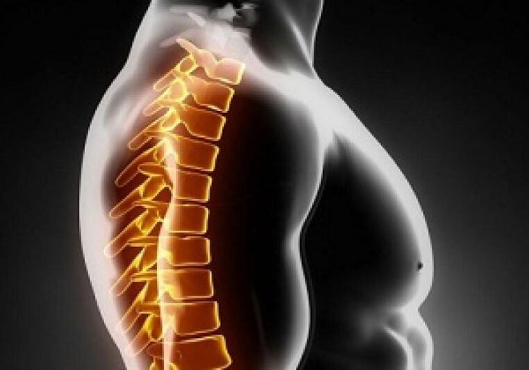 Krūtinės ląstos osteochondrozę lydi skausmas ir diskomfortas nugaros viduryje